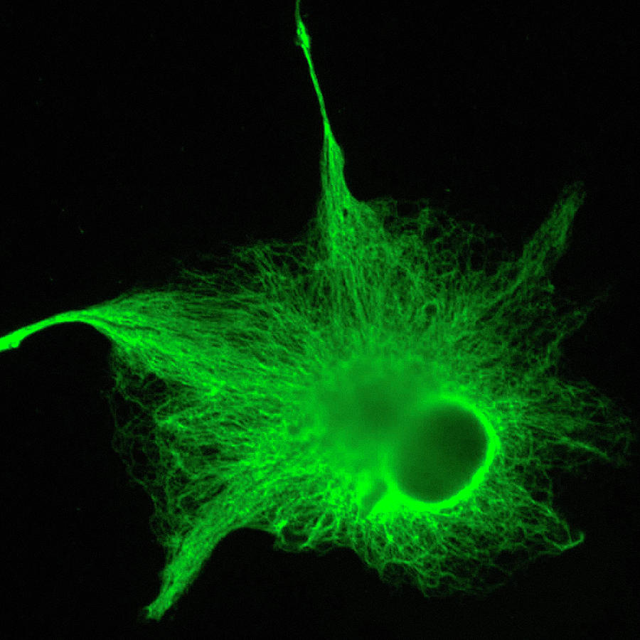 Astrocyte Nerve Cell Photograph by Riccardo Cassiani-ingoni