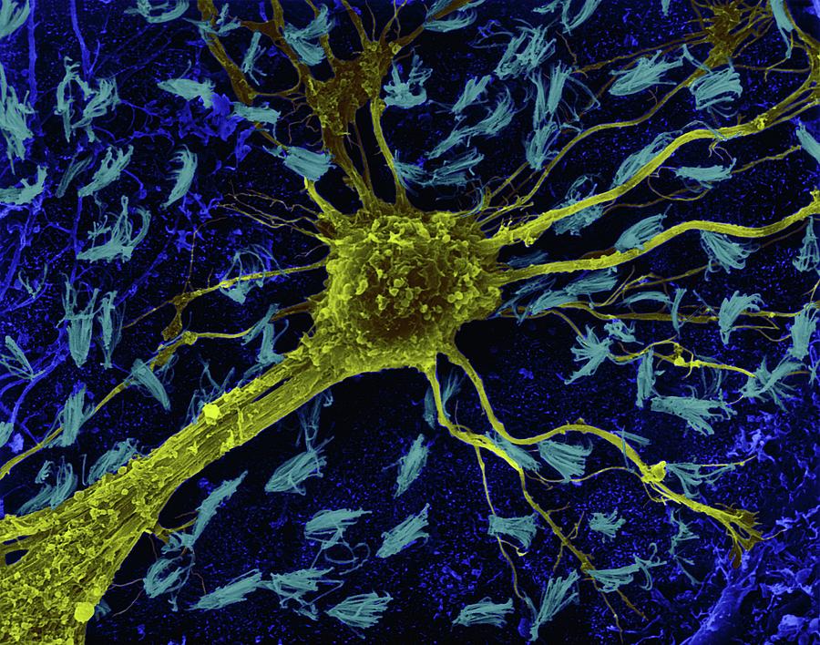 Astrocytic Glial Cell From Cns #2 Photograph by Dennis Kunkel Microscopy/science Photo Library