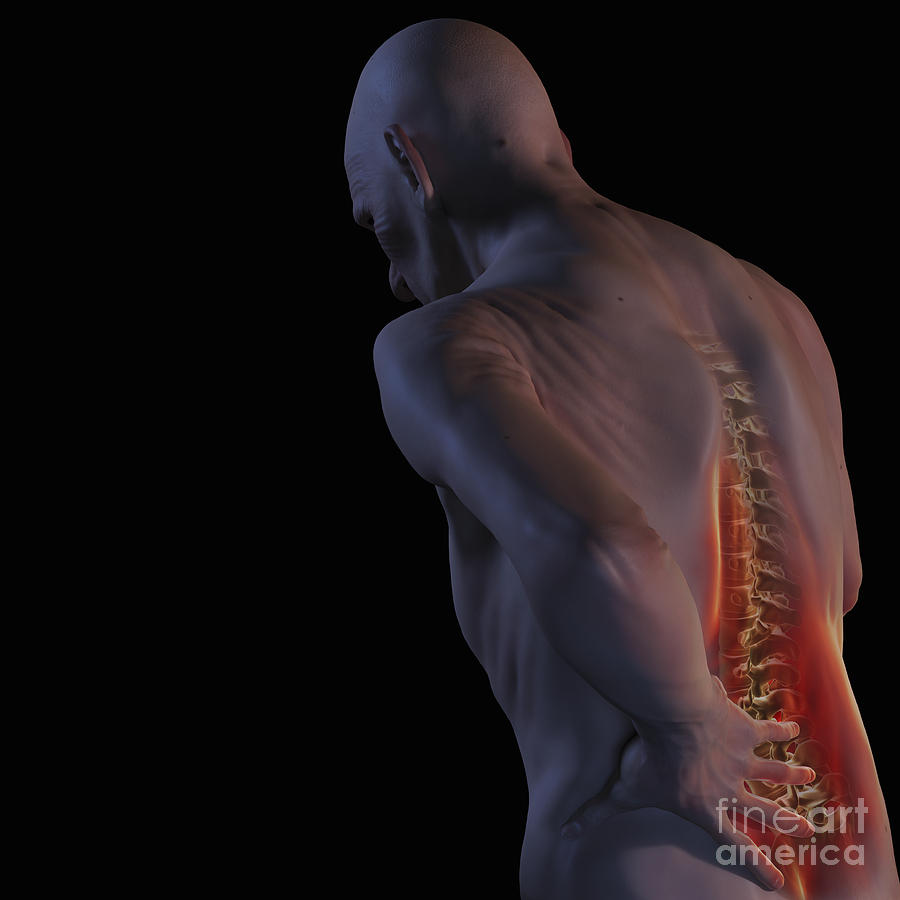 Back Pain #2 Photograph by Science Picture Co
