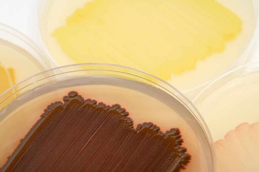 Bacterial Culture Plates #2 Photograph by Science Stock Photography