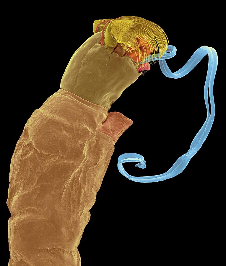 Black Fly Larva #2 Photograph by Dennis Kunkel Microscopy/science Photo Library