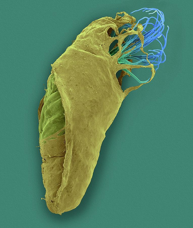 Black Fly Pupa #2 Photograph by Dennis Kunkel Microscopy/science Photo Library