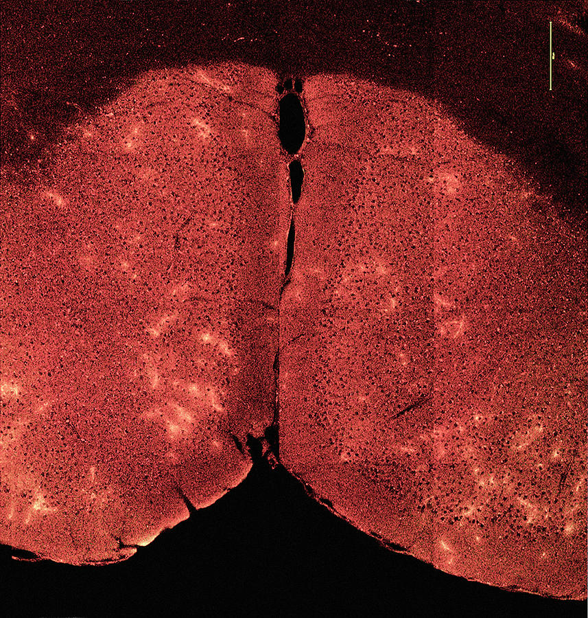Blood-brain Barrier Breakdown #2 Photograph by C.j.guerin, Phd, Mrc Toxicology Unit/ Science Photo Library