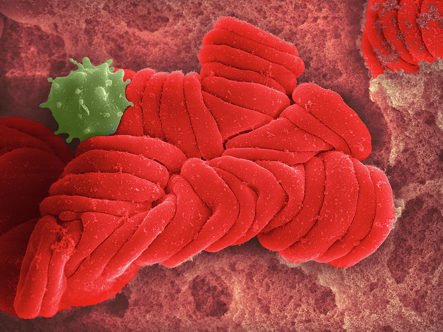 Blood Clot #2 Photograph by Science Photo Library