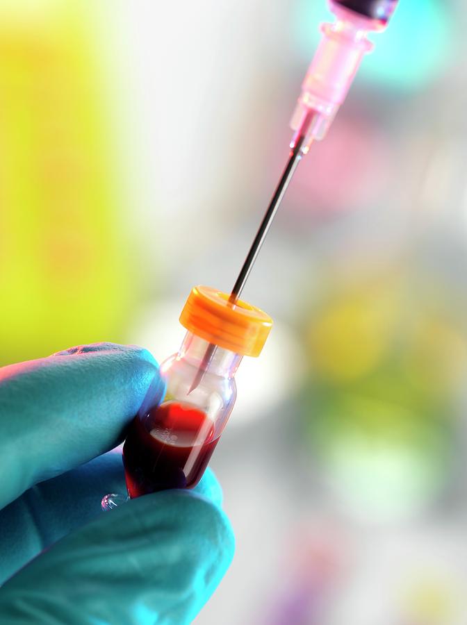 Blood Sample Photograph by Tek Image/science Photo Library - Fine Art ...