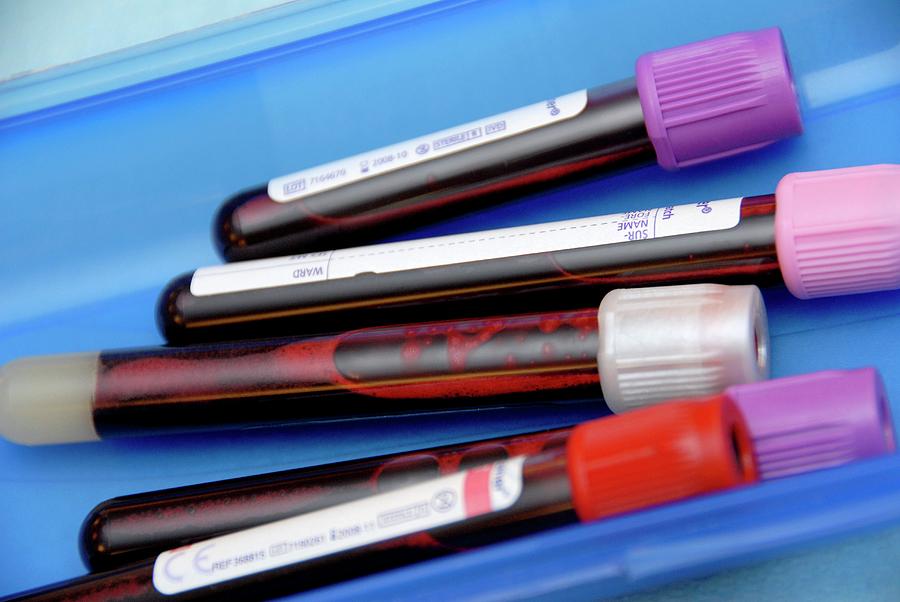 Blood Samples #2 Photograph by Aj Photo/science Photo Library