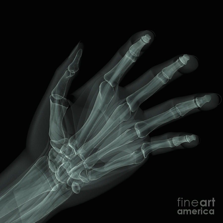 Bones Of The Hand Photograph By Science Picture Co - Fine Art America