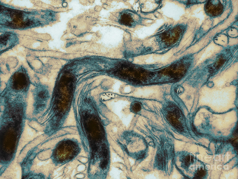 Borrelia Burgdorferi Lyme Disease Tem #3 Photograph by David M Phillips