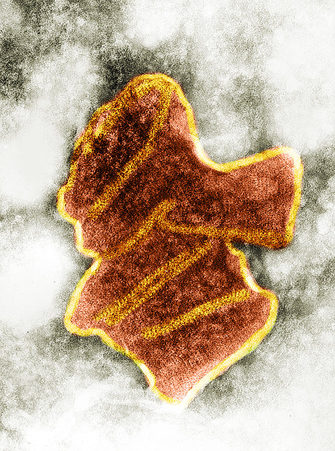 Bovine Ephemeral Fever Virus, Tem #2 Photograph by Science Source