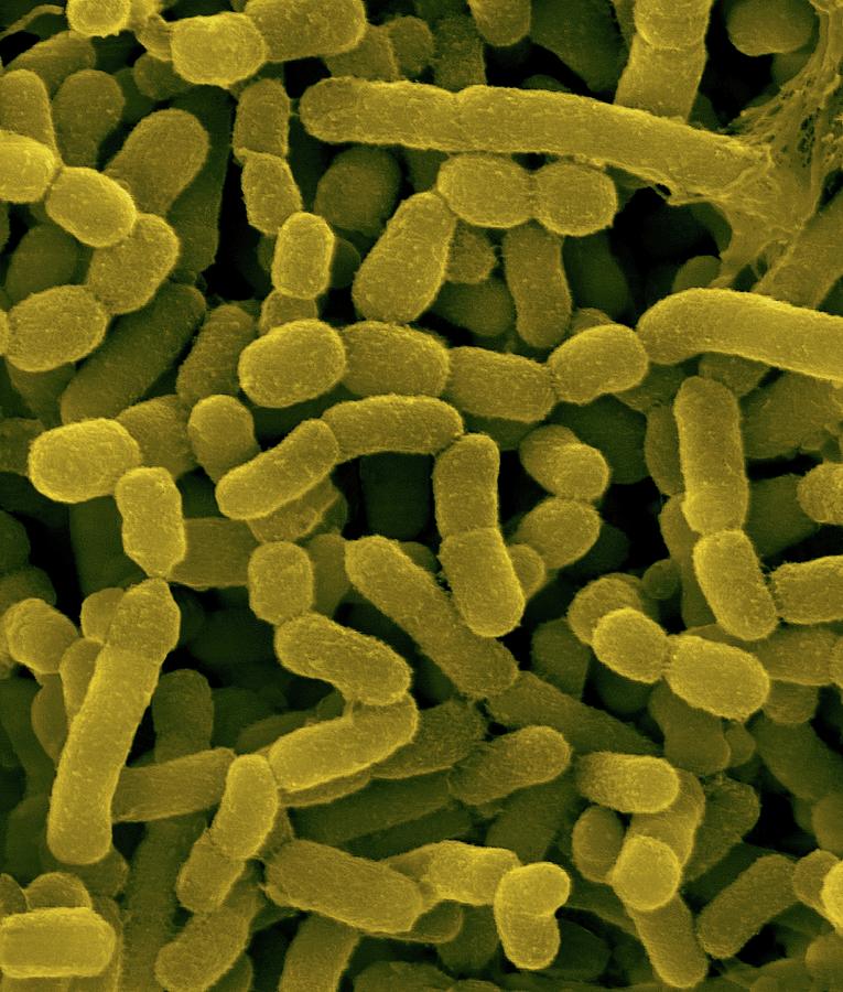 Признаки гнилостных бактерий. Разлагающие бактерии. Clostridium botulinum микроскоп. Гнилостные бактерии. Firmicutes бактерии.