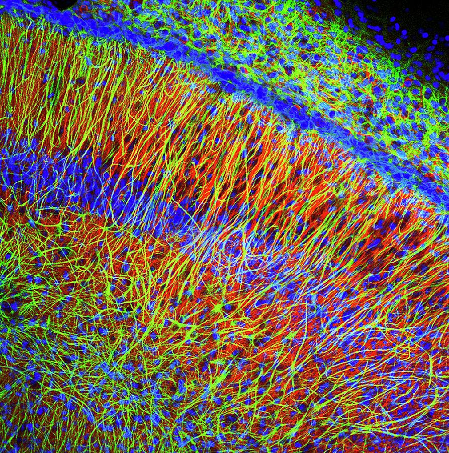 Brain Cells #2 Photograph by Dr. Chris Henstridge