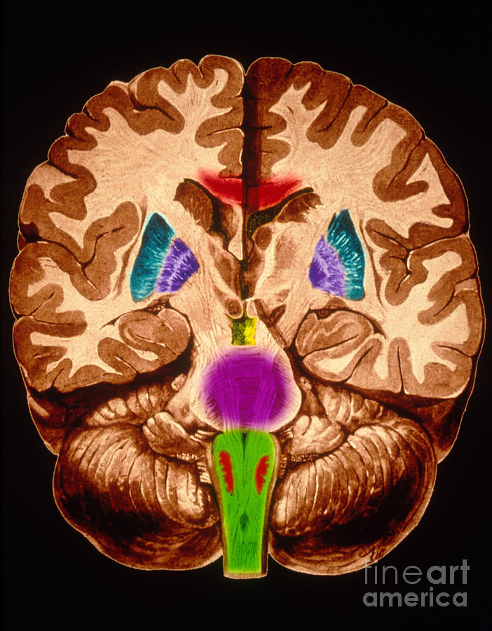 Brain, Coronal Section #2 Photograph by Scott Camazine