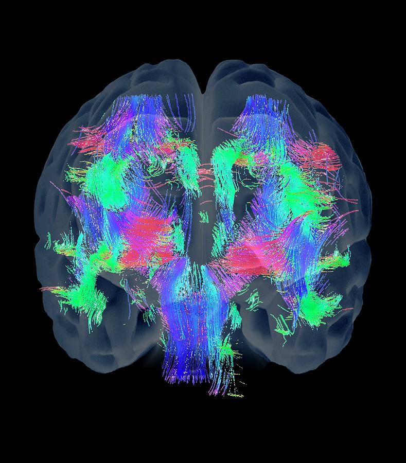 Brain matter. Light Brain украшения.