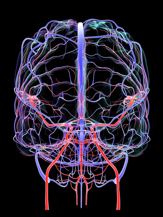 Brain's Blood Supply Photograph by Alfred Pasieka/science Photo Library ...