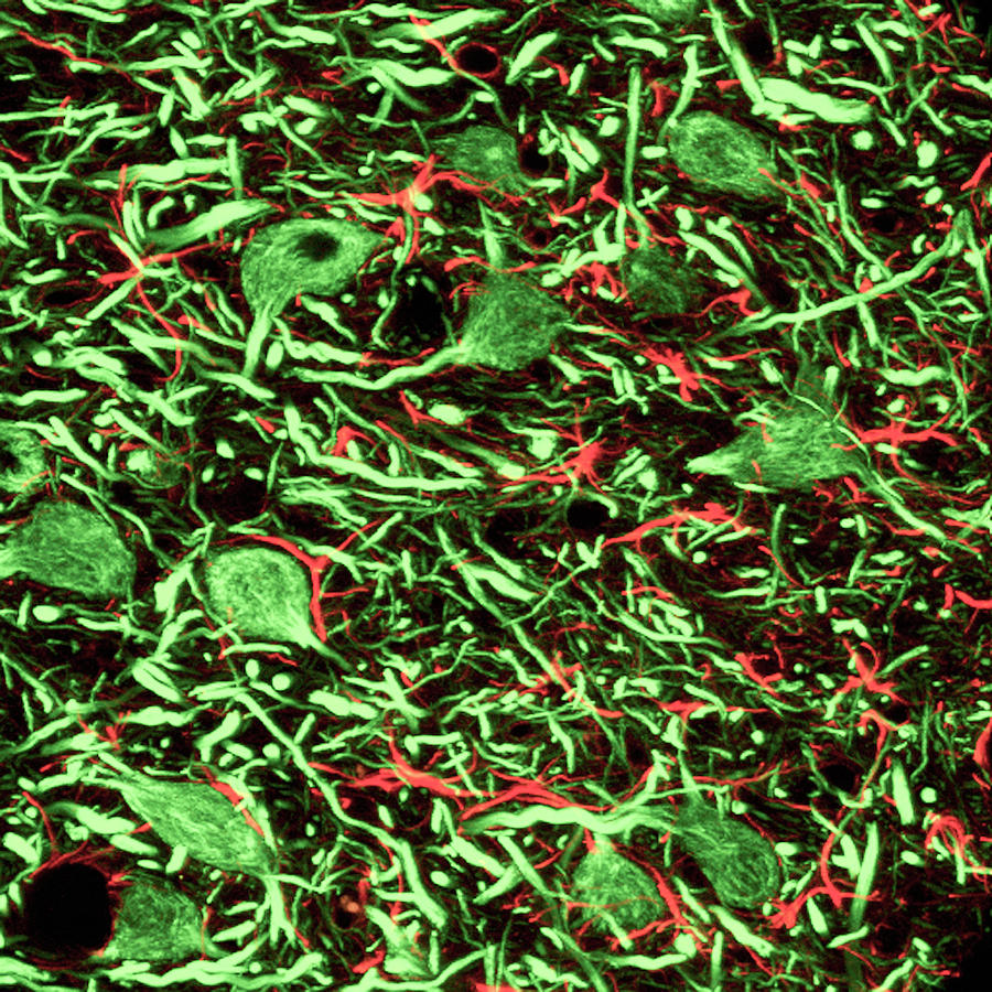 Brainstem Nerve Cells #2 Photograph by C.j.guerin, Phd, Mrc Toxicology Unit/ Science Photo Library