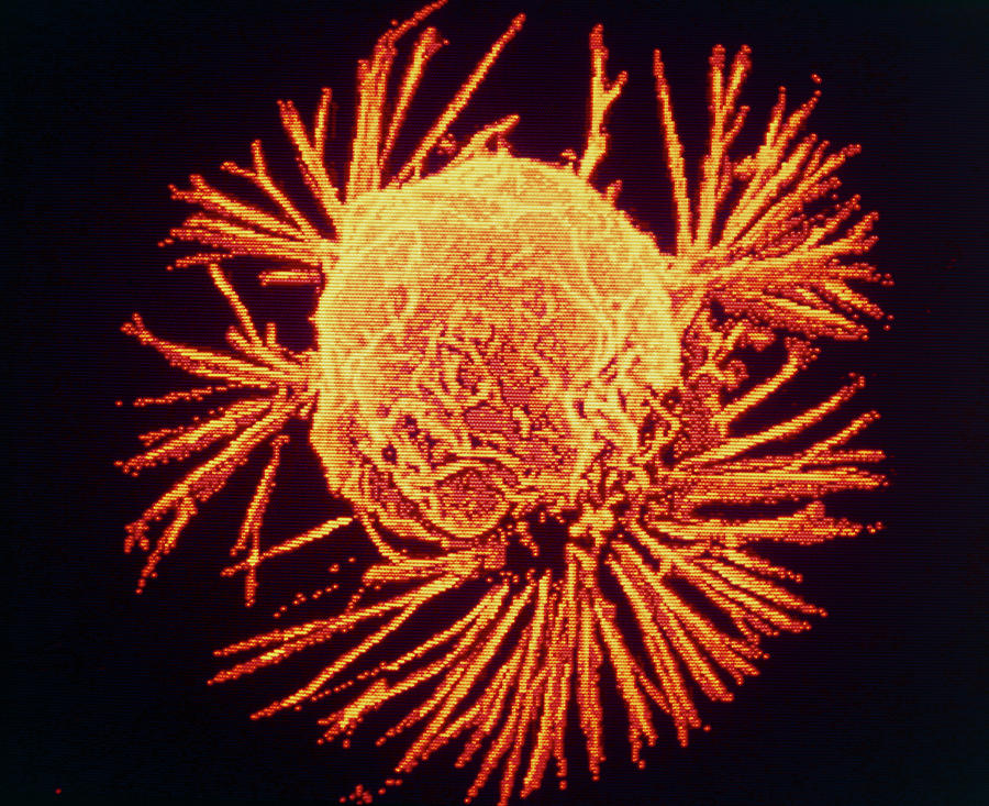 Cell Photograph - Breast Cancer Cell #2 by National Cancer Institute/science Photo Library