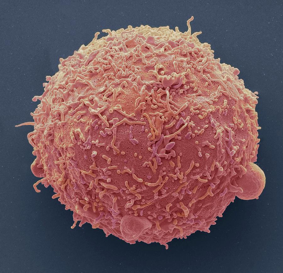 Breast Cancer Cell #2 Photograph by Steve Gschmeissner - Fine Art America