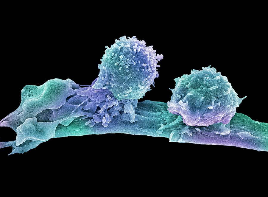 Antigen Photograph - Cancer Cell And T Lymphocytes #2 by Steve Gschmeissner