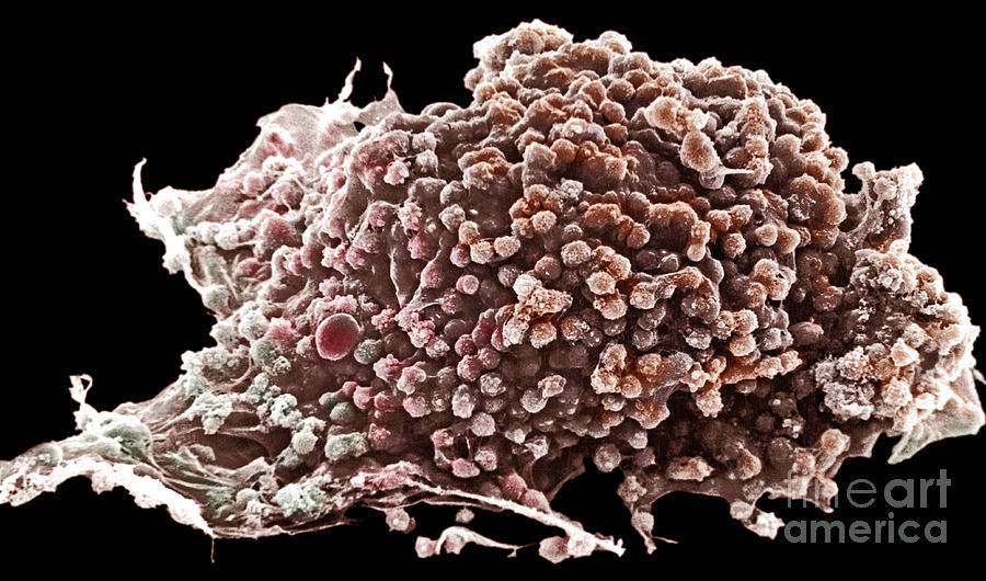 Cancer Photograph - Cancer Cell #2 by David M. Phillips