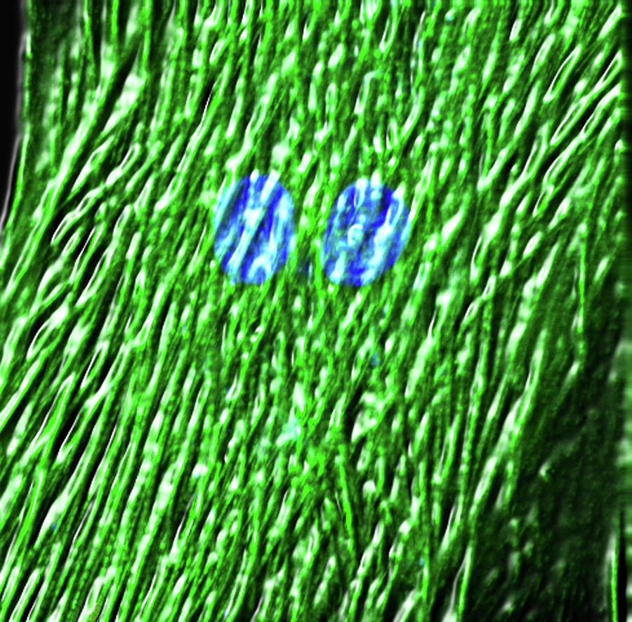 Cardiac Cell Differentiation #2 Photograph by R. Bick, B. Poindexter, Ut Medical School/science Photo Library
