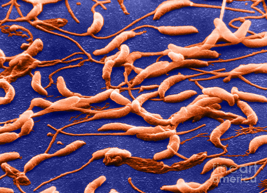 Caulobacter Crescentus, Sem #2 Photograph by Biology Pics
