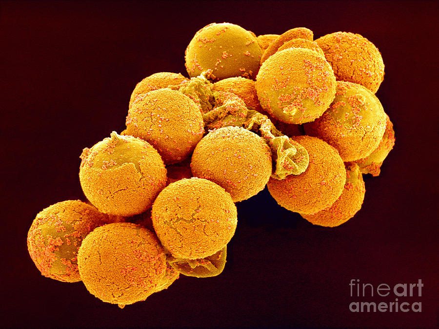 Cedar Pollen, Sem Photograph by Susumu Nishinaga