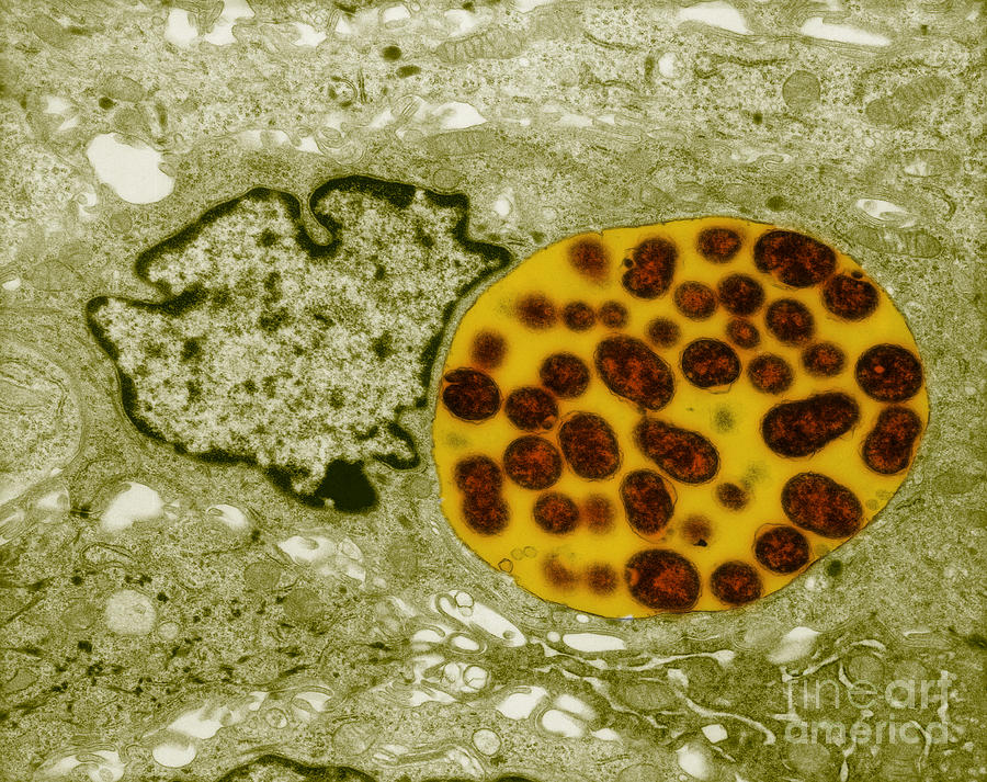 Chlamydia Infection, Tem #2 Photograph by David M. Phillips