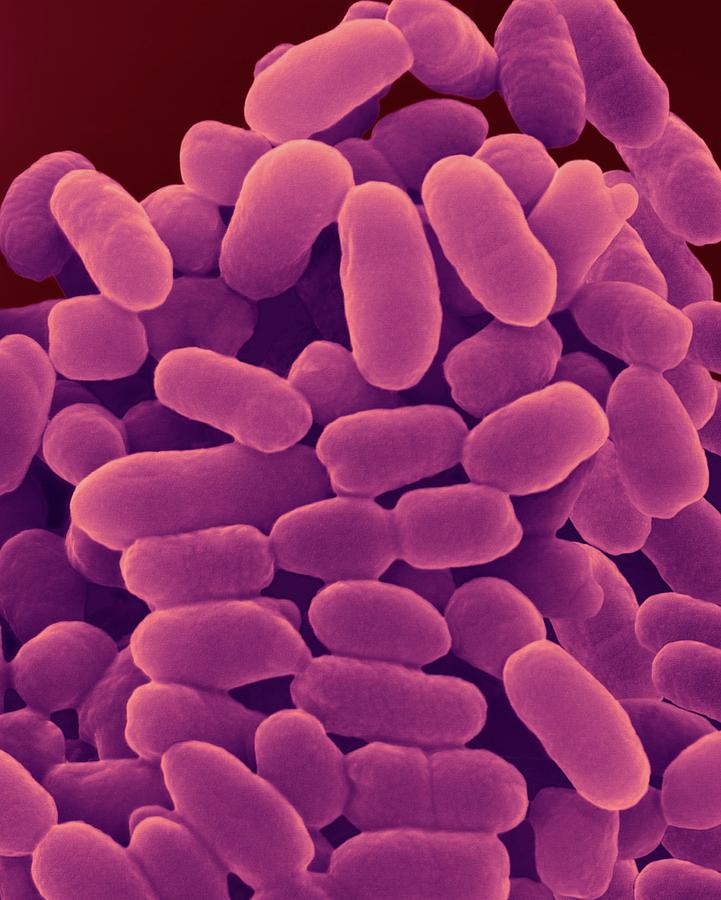 Chromatium Sp. Purple Sulphur Bacterium #2 by Science Photo Library