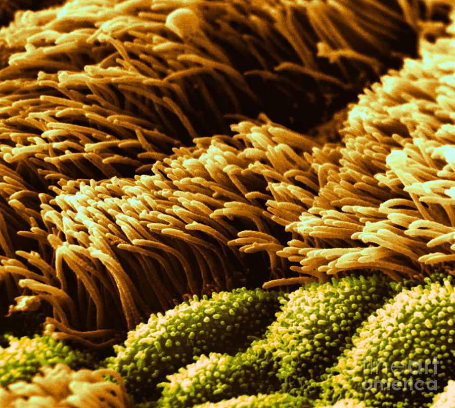 Cilia In Lung, Sem #2 Photograph by David M. Phillips