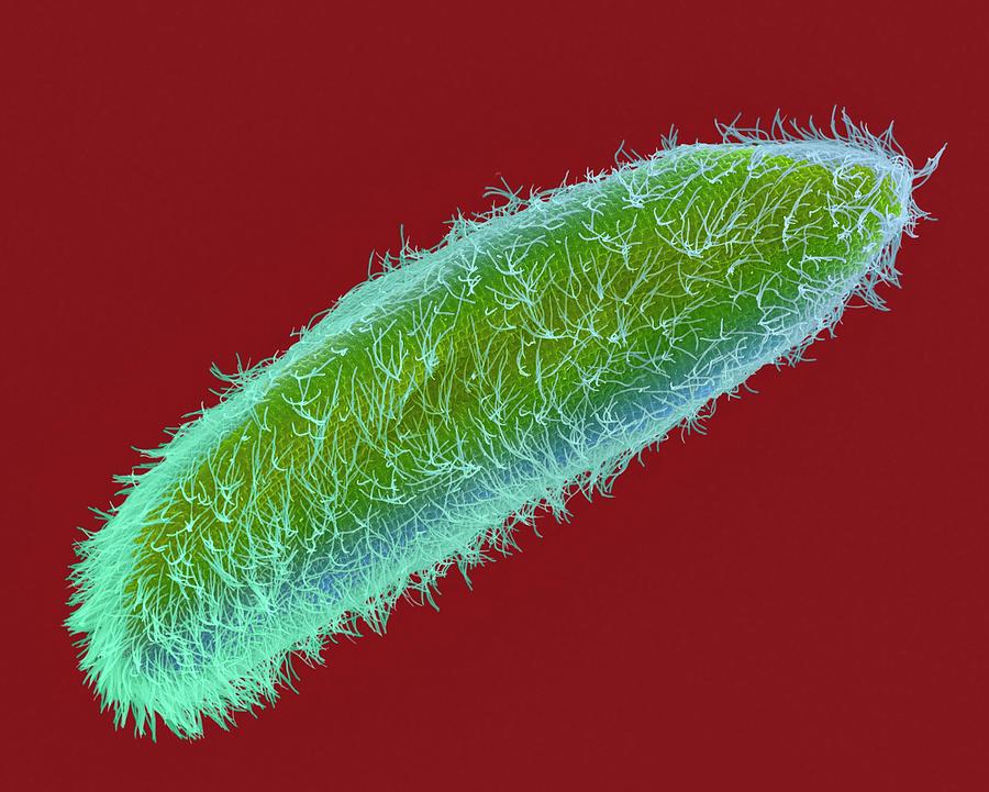 Protozoa Photograph - Ciliated Protozoan (paramecium Sp.) #2 by Dennis Kunkel Microscopy/science Photo Library