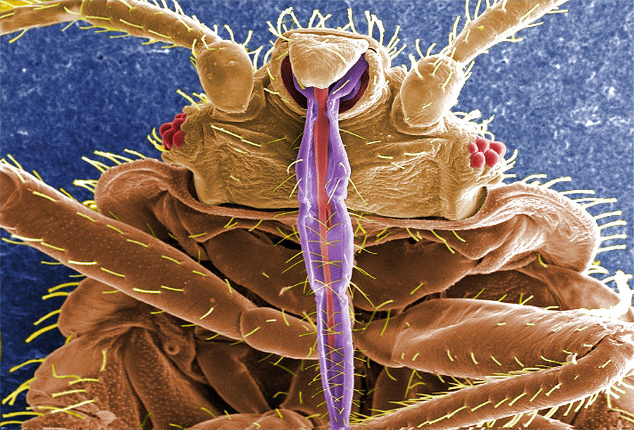 Cimex Lectularius, Bed Bug, Sem #2 Photograph by Science Source
