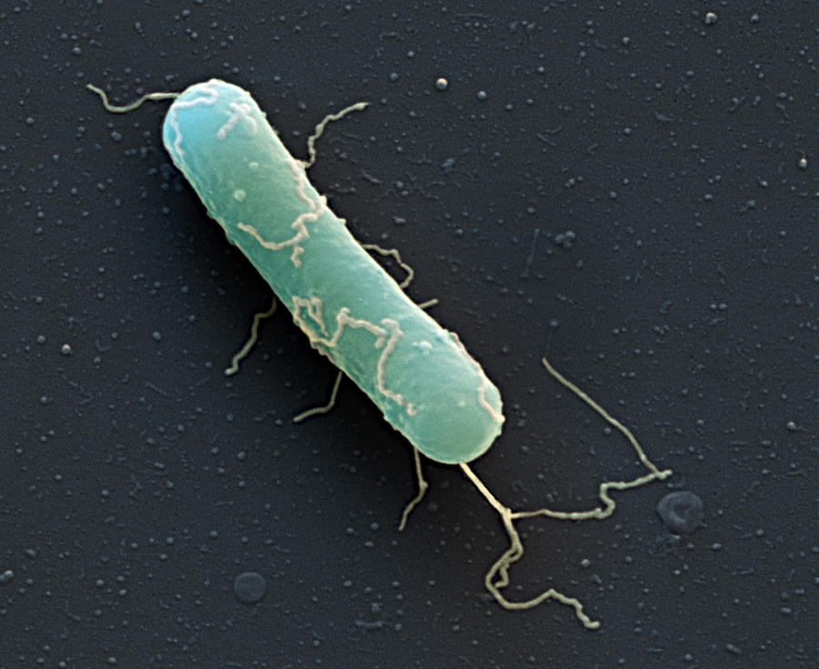 Clostridium Botulinum, Sem #2 Photograph by Eye of Science