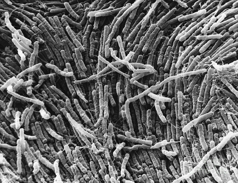 Clostridium, Sem #2 Photograph by David M. Phillips