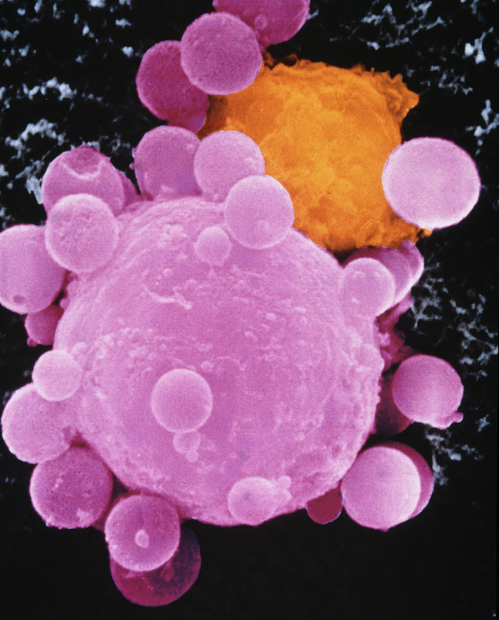 Coloured Sem Of Lymphocyte Attacking Cancer Cell Photograph by Dr ...