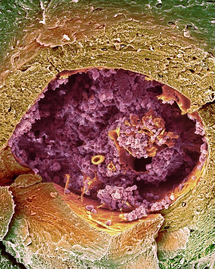 Compact Bone And Bone Marrow #2 Photograph by Dennis Kunkel Microscopy/science Photo Library