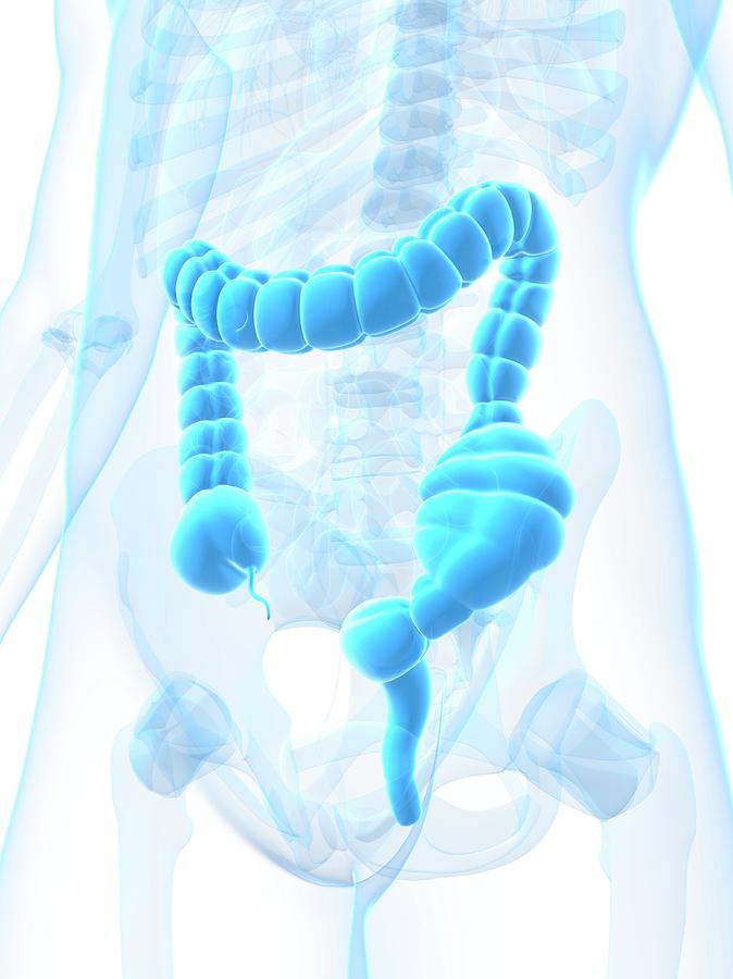 Constipated Colon Photograph By Scieproscience Photo Library Fine Art America 3543