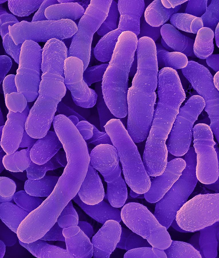 Corynebacterium Tuberculostearicum #2 Photograph by Dennis Kunkel Microscopy/science Photo Library