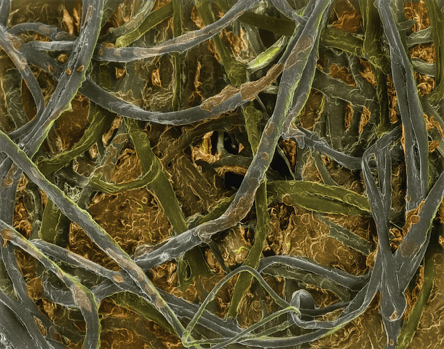 Cellulose Photograph - Cotton Bud With Ear Wax Embedded In Fibres #2 by Dennis Kunkel Microscopy/science Photo Library