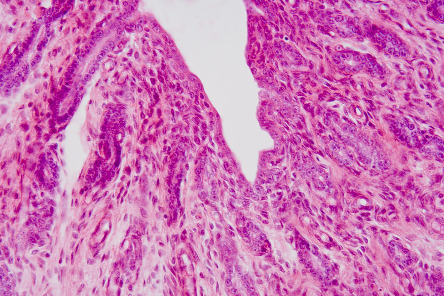 Cross-section Through Human Vagina, Lm Photograph by Science Stock ...