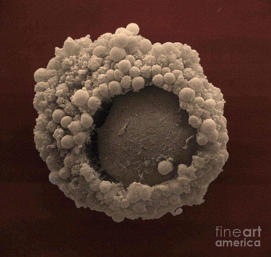 Cumulus Oophorus Cells #2 Photograph by David M. Phillips