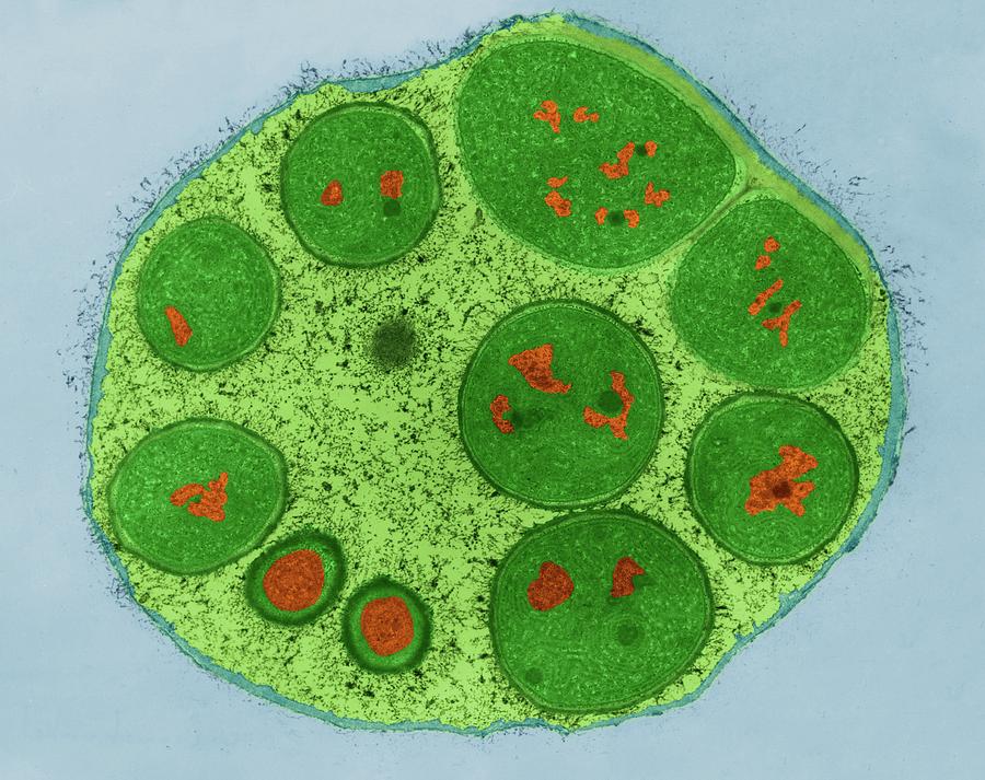 Cyanobacteria Endospores (dermocarpa Sp.) Photograph by Dennis Kunkel ...