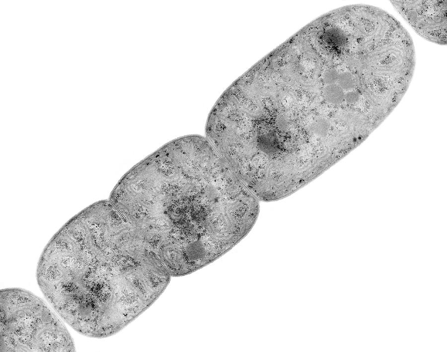 Cyanobacterium (nostoc Sp.) #2 Photograph by Dennis Kunkel Microscopy/science Photo Library