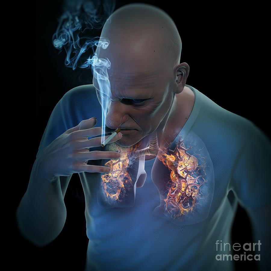 Dangers Of Smoking #2 Photograph by Science Picture Co