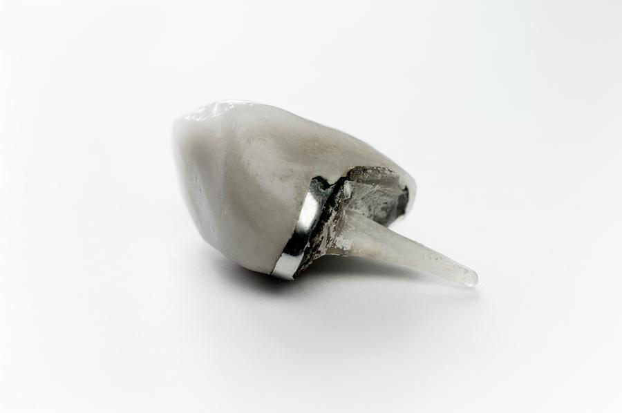 Detached Dental Crown For A Canine Tooth Photograph by Dr Jeremy ...