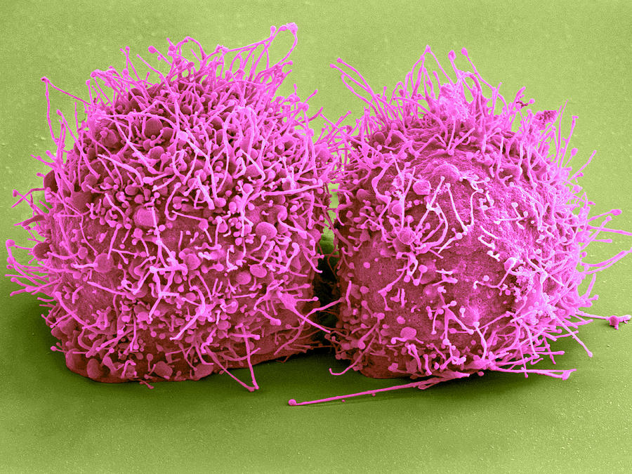 Dividing Hela Cells, Sem #2 Photograph by Science Source