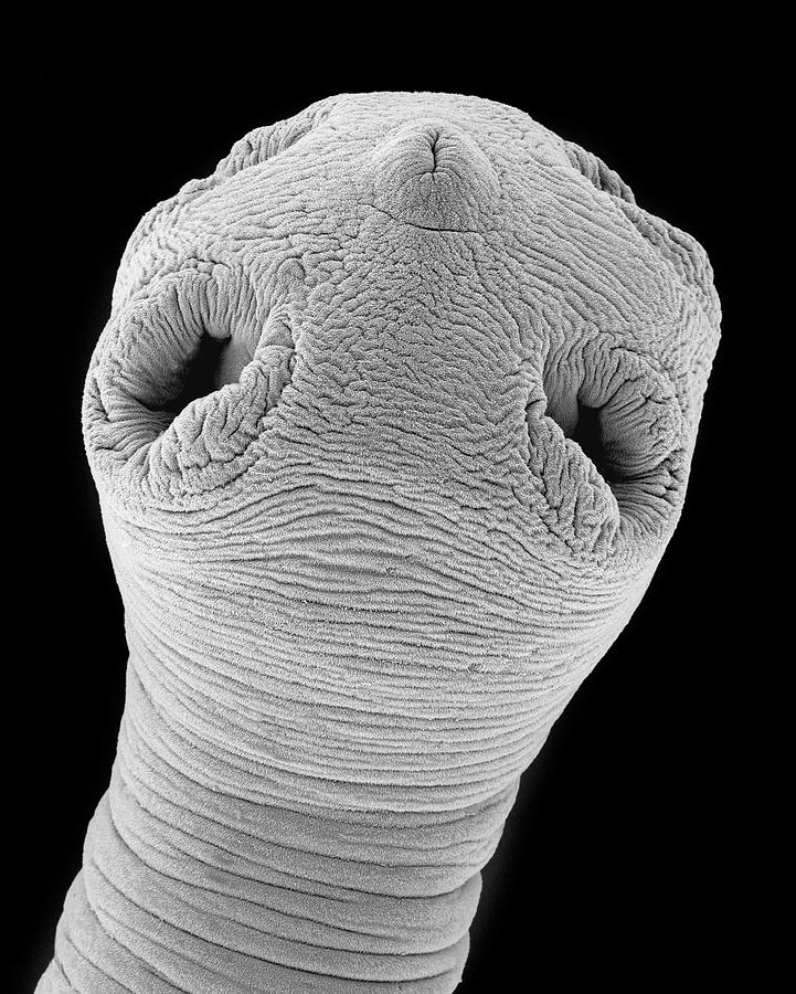 Dog Tapeworm Scolex (dipylidium Caninum) Photograph by