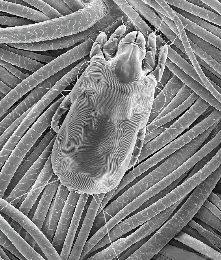 Dust Mite On Wool Fabric Photograph by Dennis Kunkel Microscopy/science ...