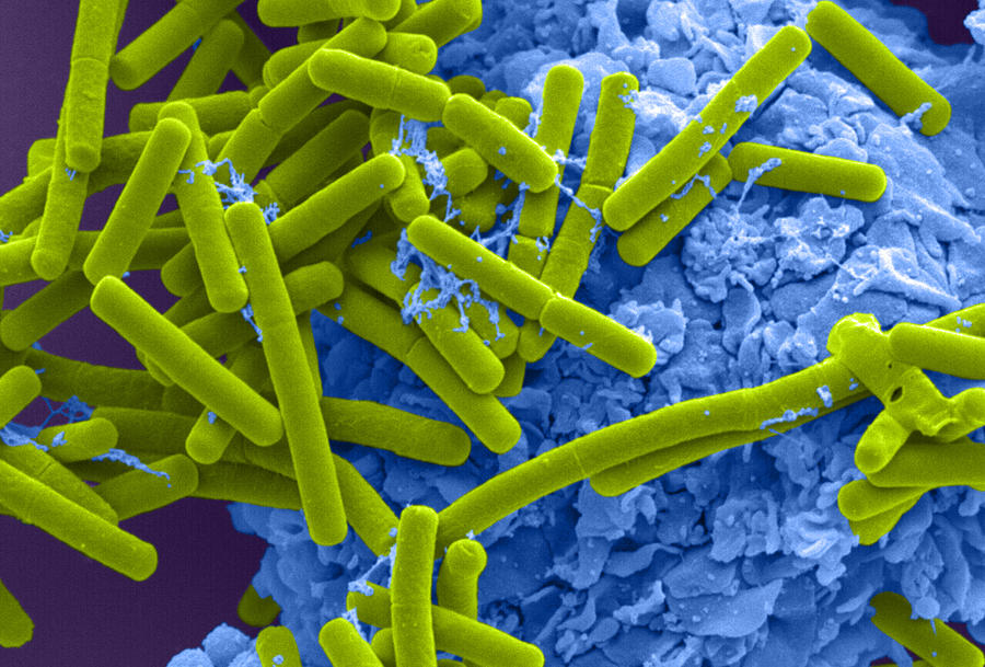 E. Coli And Macrophage Sem #2 Photograph by Science Source