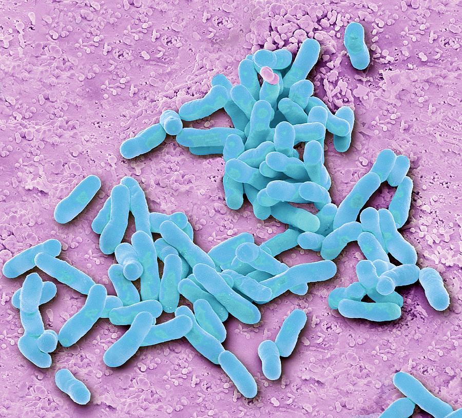 E. Coli Bacteria Photograph by Steve Gschmeissner/science Photo Library ...