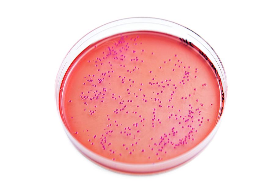 E. Coli Photograph - E. Coli Bacterial Culture by Lewis Houghton/science Ph...
